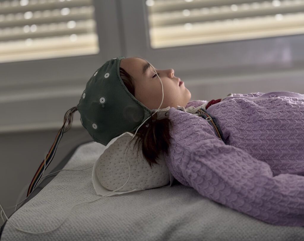 Electrodos de registro cerebral colocados sobre el cuero cabelludo con cables ordenados